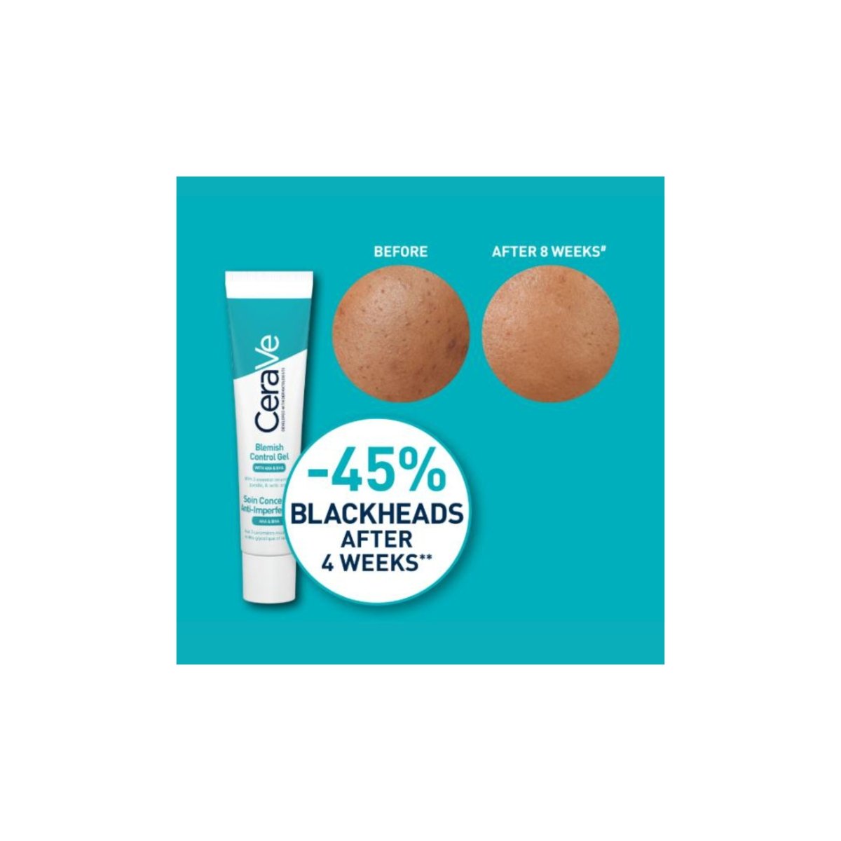 CeraVe Blemish Control Gel 40 ml - Bloom Shine