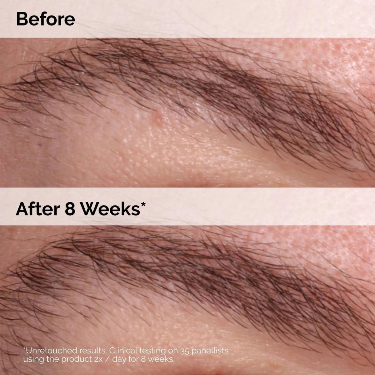 The Ordinary Multi - Peptide Lash and Brow Serum 5ml - Bloom Shine