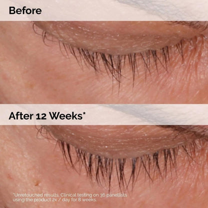 The Ordinary Multi - Peptide Lash and Brow Serum 5ml - Bloom Shine
